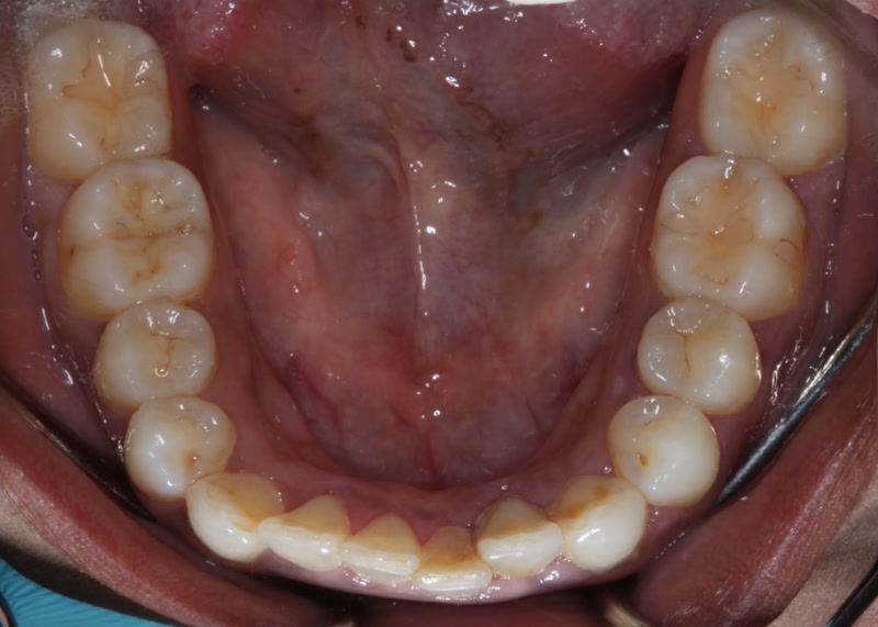 DH Dental   Prosthodontics | Full Mouth Reconstruction, Dental Implants and Cleanings   Exams