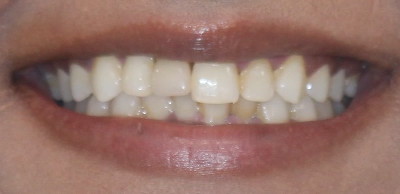 DH Dental   Prosthodontics | Dentures, Crowns and Cleanings   Exams