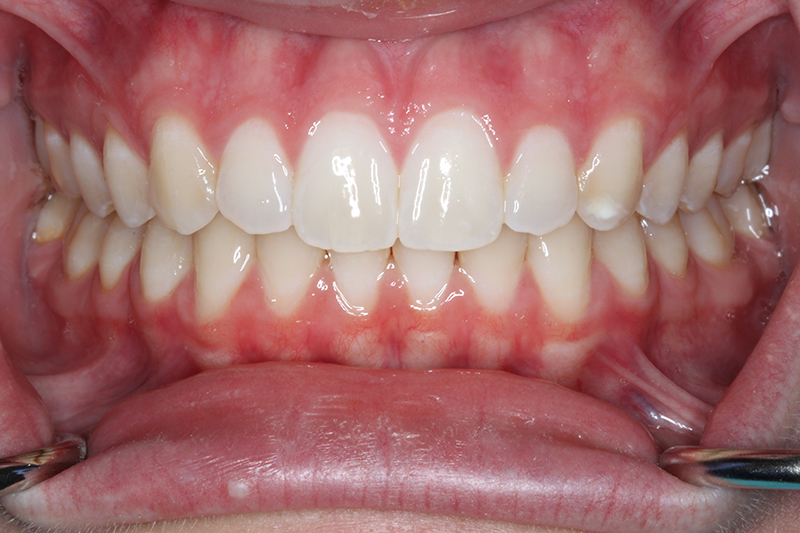 DH Dental & Prosthodontics | Oral Cancer Screening, Oral Exams and Emergency Treatment