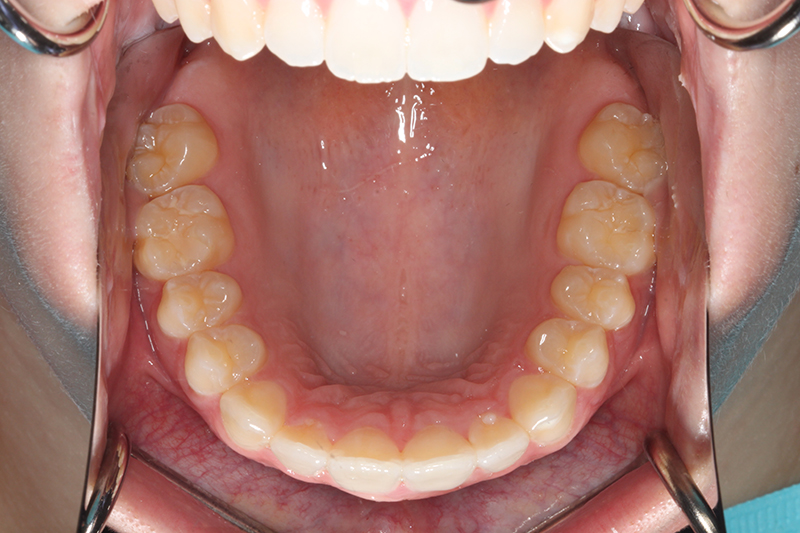 DH Dental & Prosthodontics | All-on-X, TMJ/TMD and Dental Implants