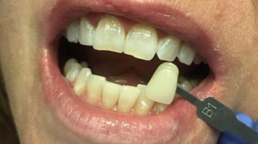 DH Dental   Prosthodontics | Emergency Treatment, Periodontal Treatment and Dental Bridges