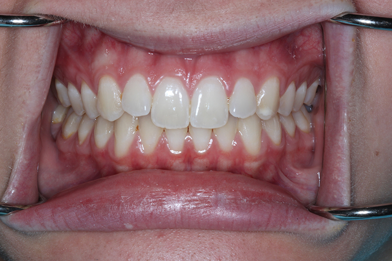 DH Dental & Prosthodontics | All-on-X, Cleanings & Exams and Emergency Treatment