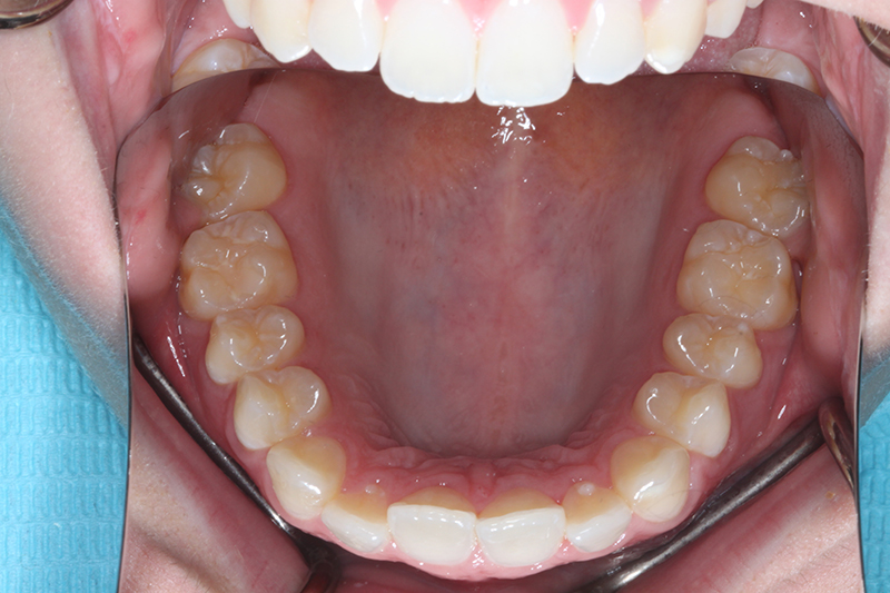 DH Dental & Prosthodontics | Night Guards, Veneers and Botox