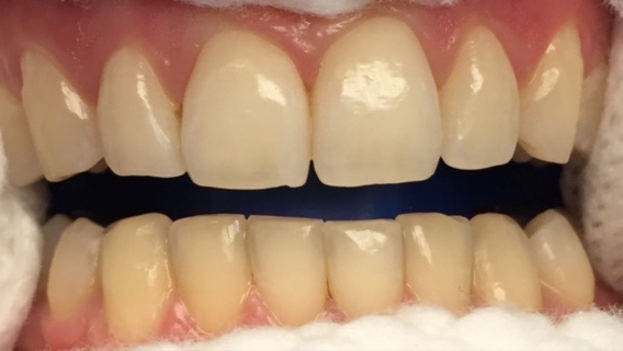 DH Dental   Prosthodontics | Emergency Treatment, Night Guards and Periodontal Treatment