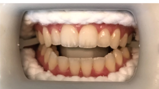 DH Dental   Prosthodontics | Oral Cancer Screening, Digital Radiography and Emergency Treatment