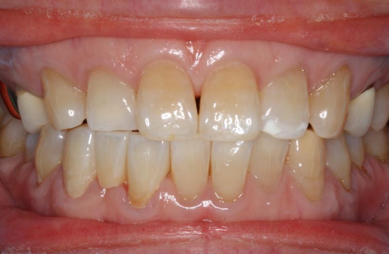 DH Dental   Prosthodontics | Periodontal Treatment, TMJ TMD and Digital Impressions