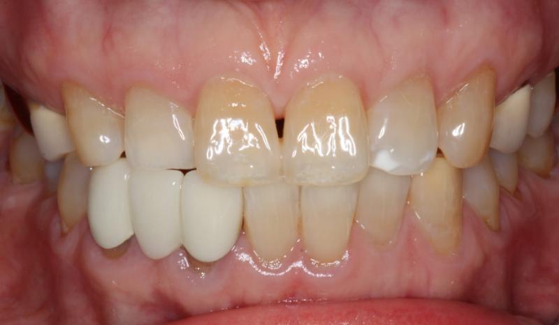 DH Dental   Prosthodontics | Dental Implants, Full Mouth Reconstruction and Digital Radiography
