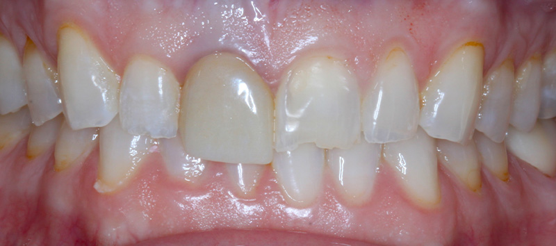 DH Dental & Prosthodontics | Digital Radiography, Oral Cancer Screening and Botox