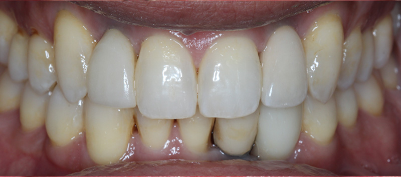 DH Dental & Prosthodontics | Botox, Emergency Treatment and Snoring Treatment