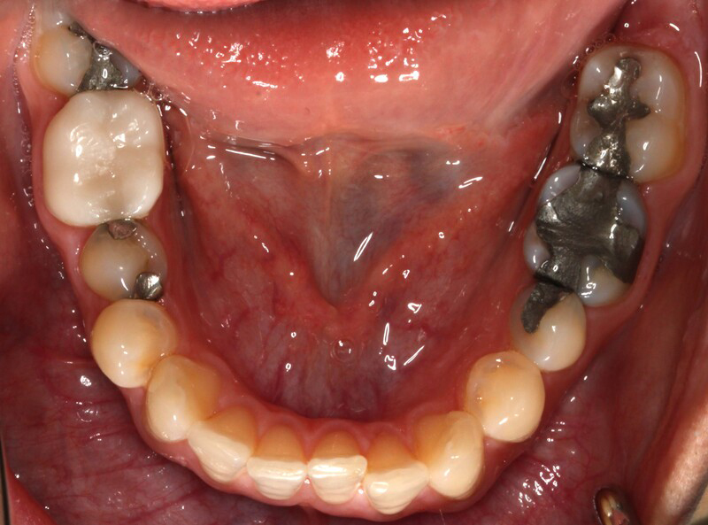 DH Dental   Prosthodontics | Oral Cancer Screening, Emergency Treatment and Botox