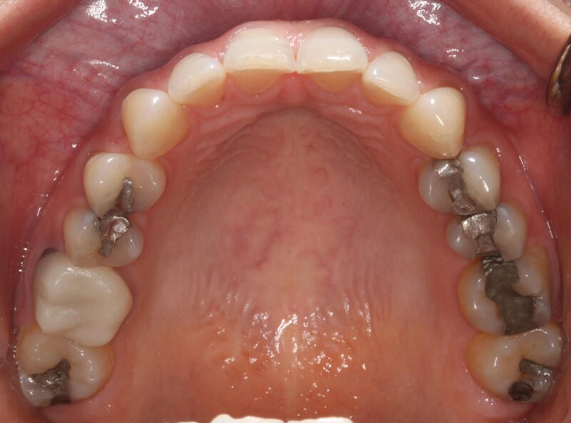 DH Dental   Prosthodontics | Dentures, Periodontal Treatment and Veneers