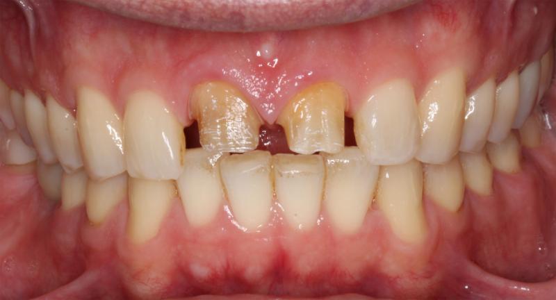 DH Dental Prosthodontics | Digital Impressions, Emergency Treatment and Preventative Care Program