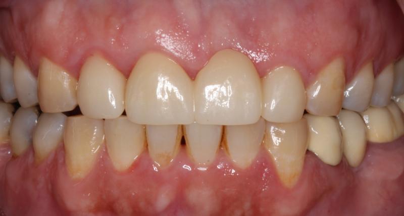 DH Dental   Prosthodontics | TMJ TMD, Cleanings   Exams and Digital Radiography