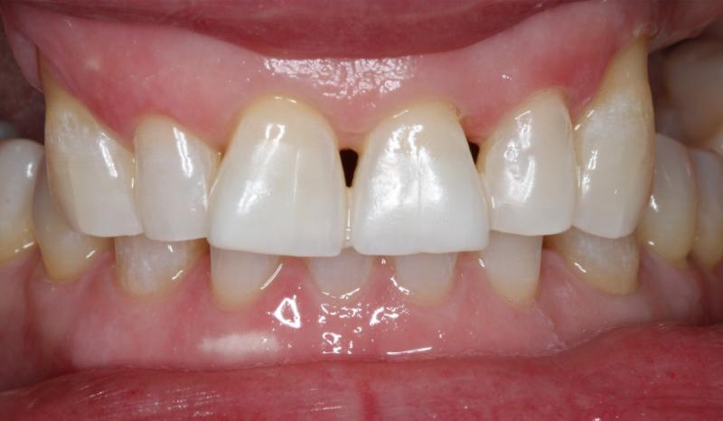 DH Dental   Prosthodontics | Digital Radiography, Snoring Treatment and Cleanings   Exams