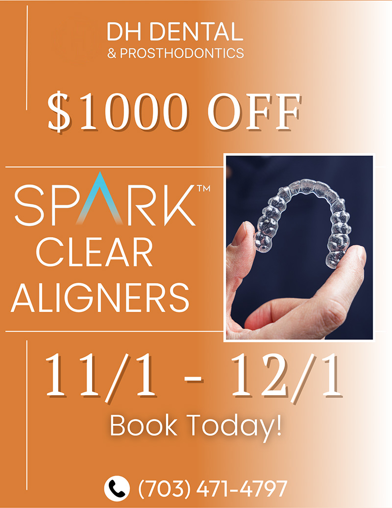 DH Dental   Prosthodontics | Full Mouth Reconstruction, Dental Implants and All-on-X