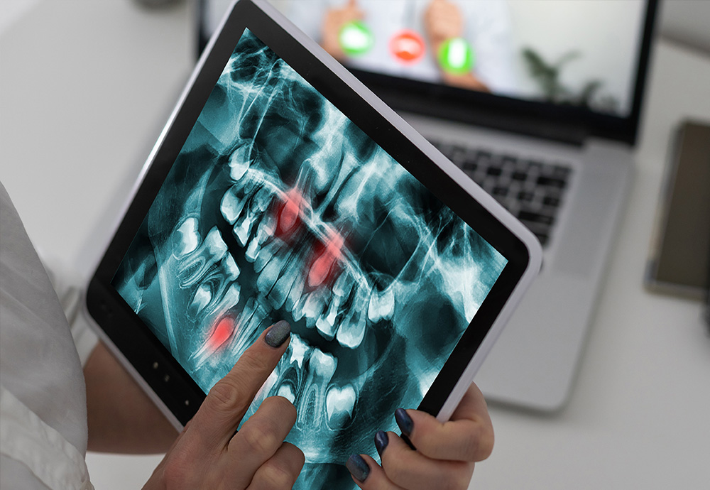 DH Dental   Prosthodontics | Dental Implants, Crowns and Digital Impressions