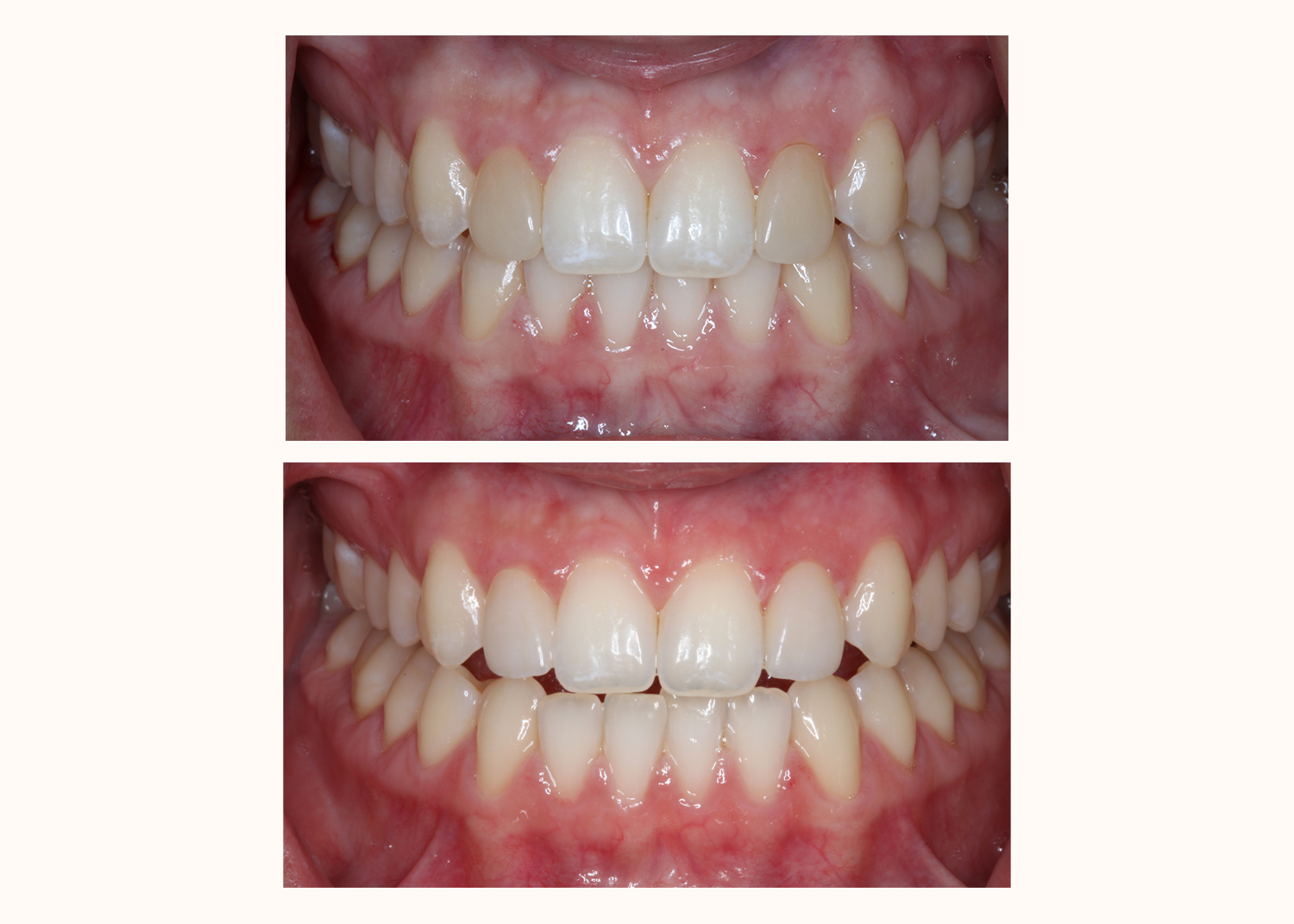 DH Dental   Prosthodontics | Dentures, Cleanings   Exams and Digital Radiography