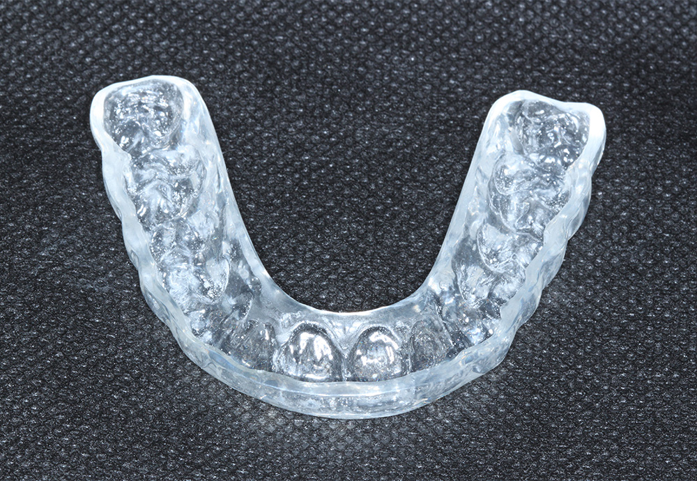 DH Dental   Prosthodontics | Spark trade  Clear Aligners, Dental Bridges and Oral Cancer Screening