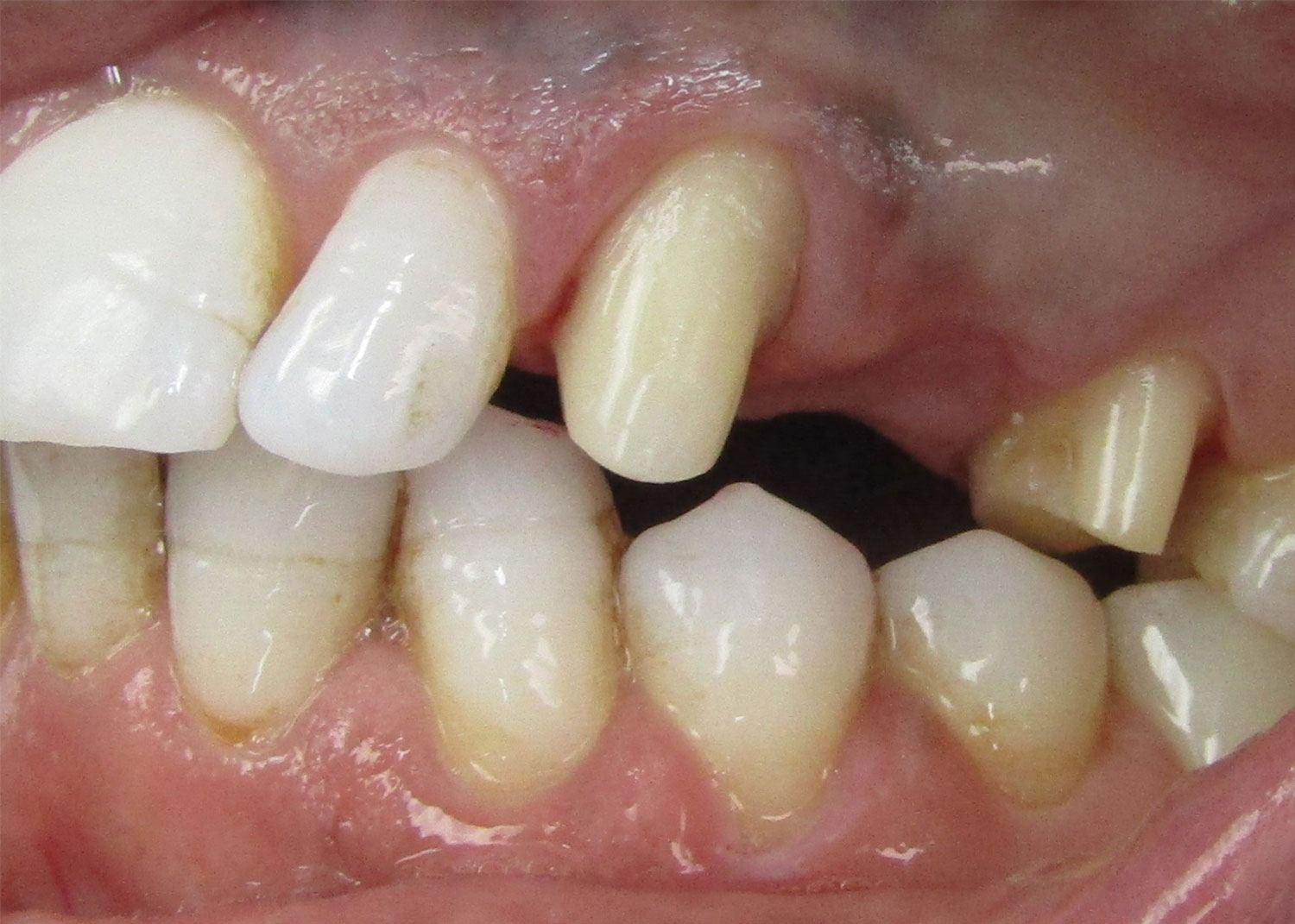 DH Dental Prosthodontics | Cleanings Exams, Dentures and Full Mouth Reconstruction